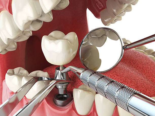 Best Knocked-Out Tooth Emergency  in Kansas City, KS